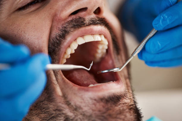 Why Choose Us for Your Dental Needs in Crescent City, CA